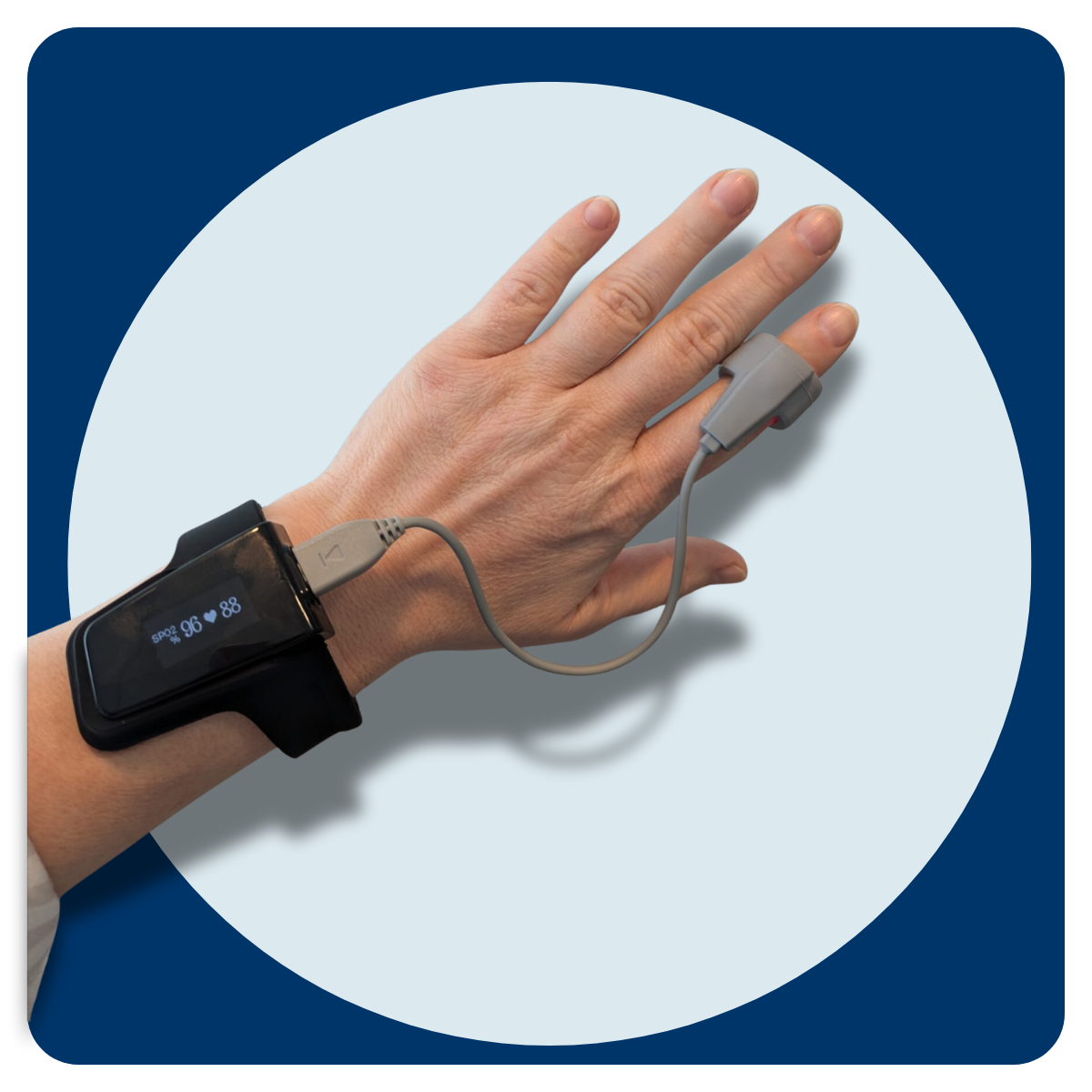 Hand with the Dream sleep test device attached. Utilized for home sleep testing and sleep apnea diagnosis.