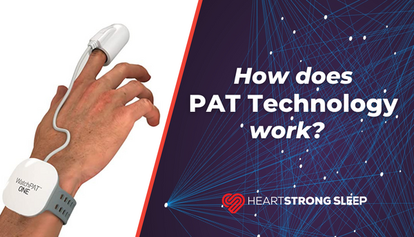 How does PAT Technology work? WatchPAT ONE Sleep Apnea Testing Device