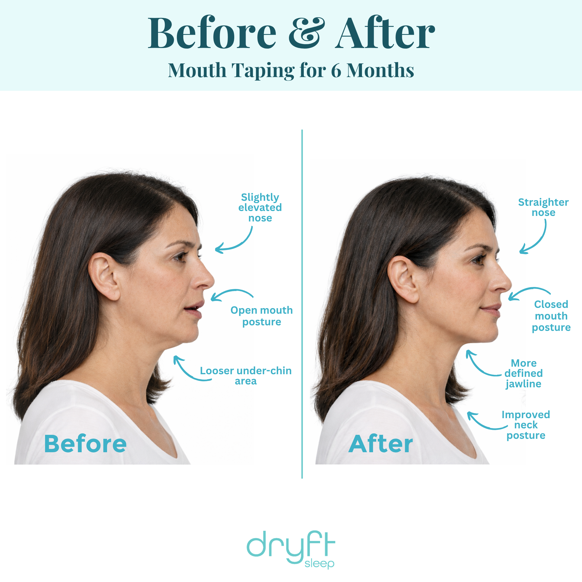 Dryft Sleep Mouth Tape - Heartstrong Sleep