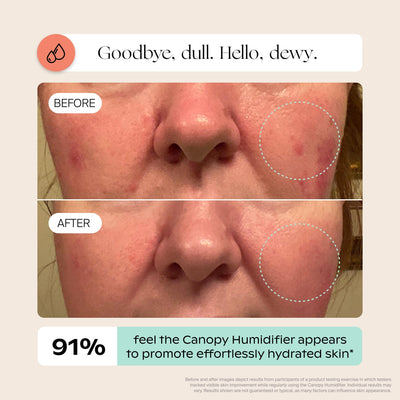 Canopy Bedside Humidifier 2.0 graphic about overnight water loss