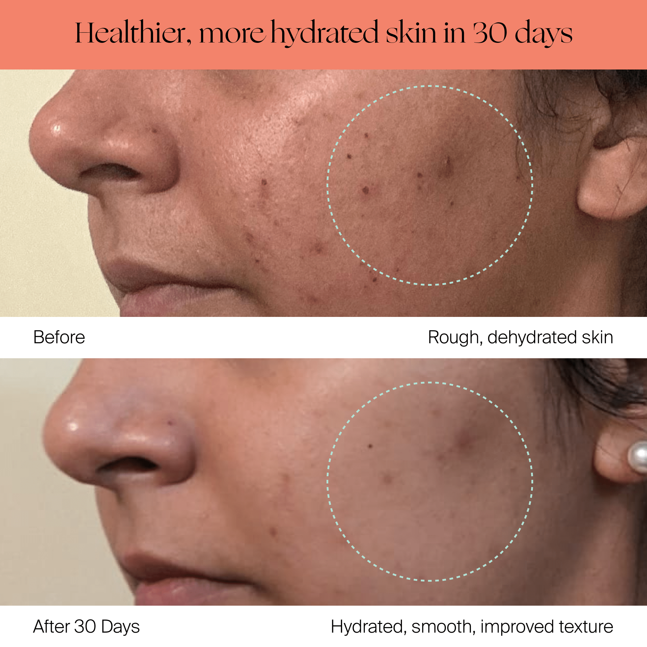 Canopy Humidifier - Sky Hydration Results on Face