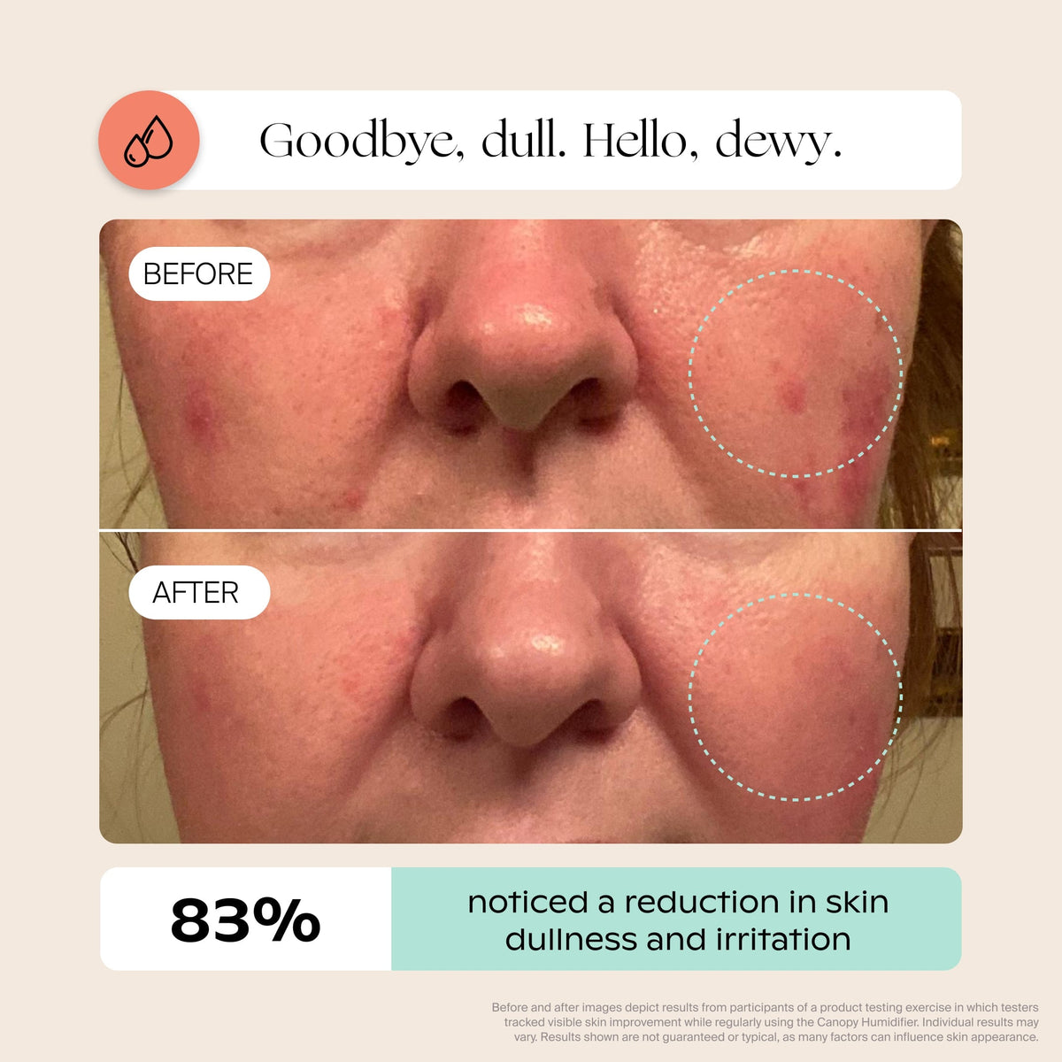 Infographic explaining skin barrier and hydration benefits of Canopy large room humidifier