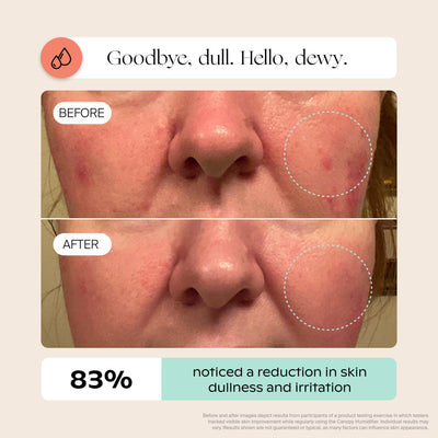 Infographic explaining skin barrier and hydration benefits of Canopy large room humidifier